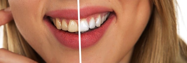 Ağız Ve Diş Sağlığı 2019 Kaç Kişi Atandı? Ağız Ve Diş Sağlığı 2019 Kaç Kişi Atandı?